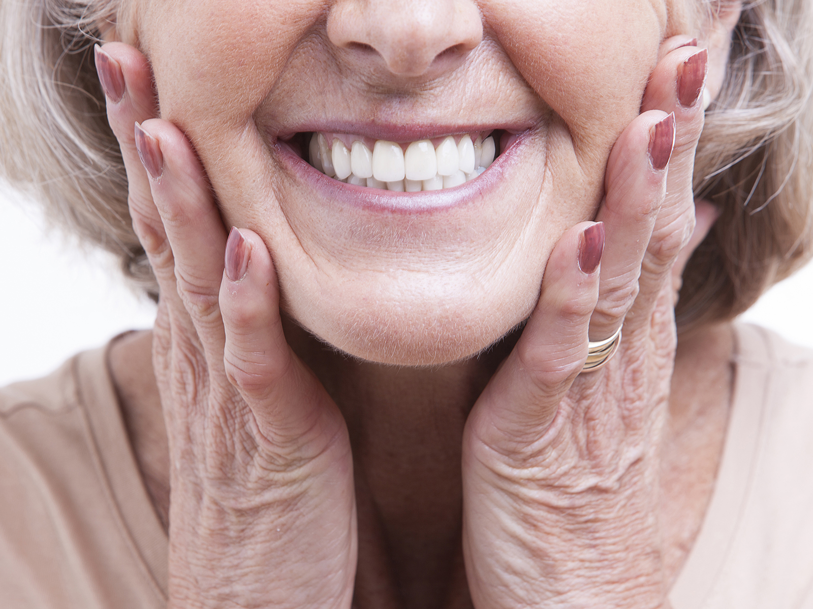 Do implant-supported dentures come out?