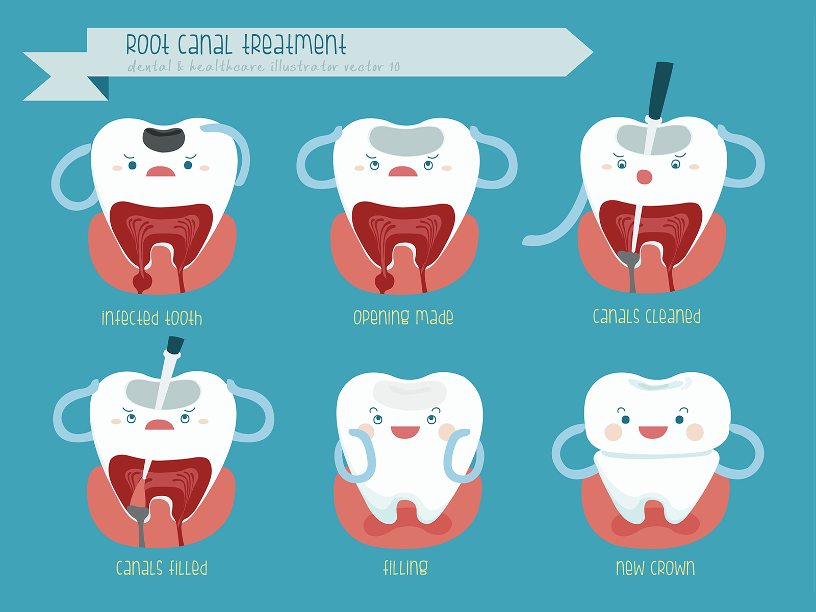 Can Teeth Still Hurt After Root Canal?
