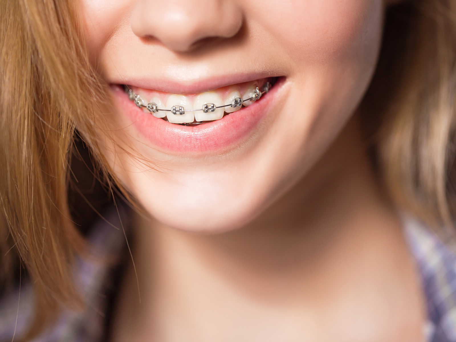 What happens in the first month of braces?