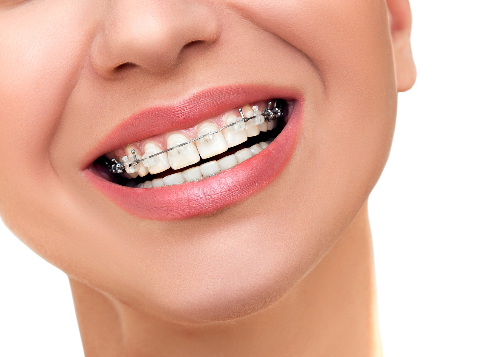 Why are braces tightened every 6 weeks?