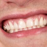 How do I make my gums stronger?