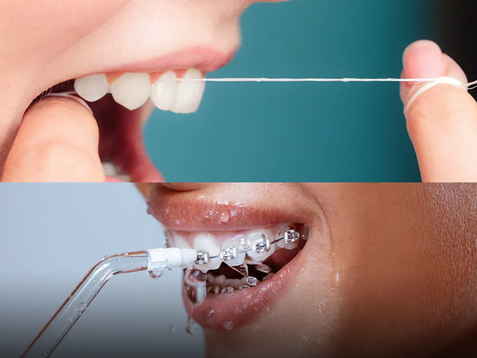 Water Flossing Vs. Traditional Flossing: Which Is Better?
